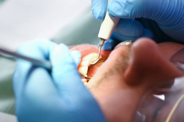 Best Urgent Dental Care for Toothache in Hollywood Park, TX