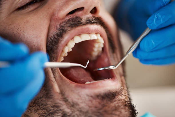 Best Weekend Emergency Dentist in Hollywood Park, TX